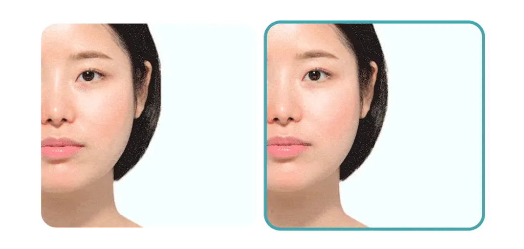 [여배우/전문가 Pick] 아떼 선케어 (선에센스EX / 무기자차 선크림 50ml 단품/기획 4종) 상세페이지 55
